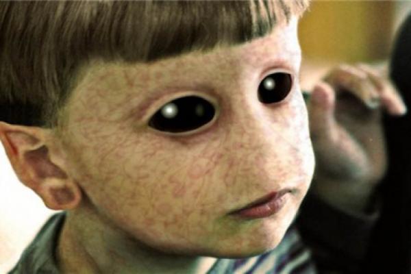 Șocant! Descoperire fără precedent! Copilul fără INIMĂ ȘI PLĂMÂNI