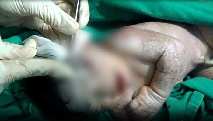 Foto cutremurător! Medicii sirieni au salvat un copil prin cezariană. Mama, lovită de şrapnelele unei bombe