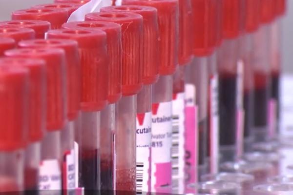 Raport DSP Dolj, la Spitalul din Craiova: Procedurile legate de transfuziile de sânge au fost respectate, pacienţii ar fi murit din alte cauze