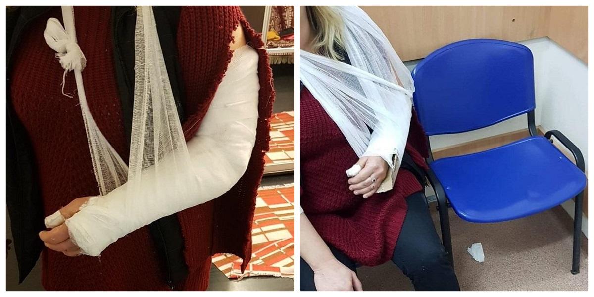 Mâna ruptă a unei femei a fost fixată de medicii din Cluj cu o bucată de carton