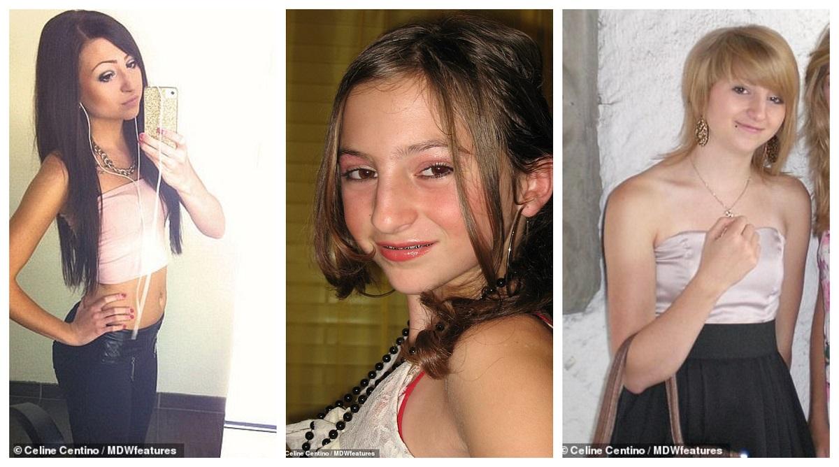 Umilită de colegi, tânăra și-a făcut mai multe operații estetice