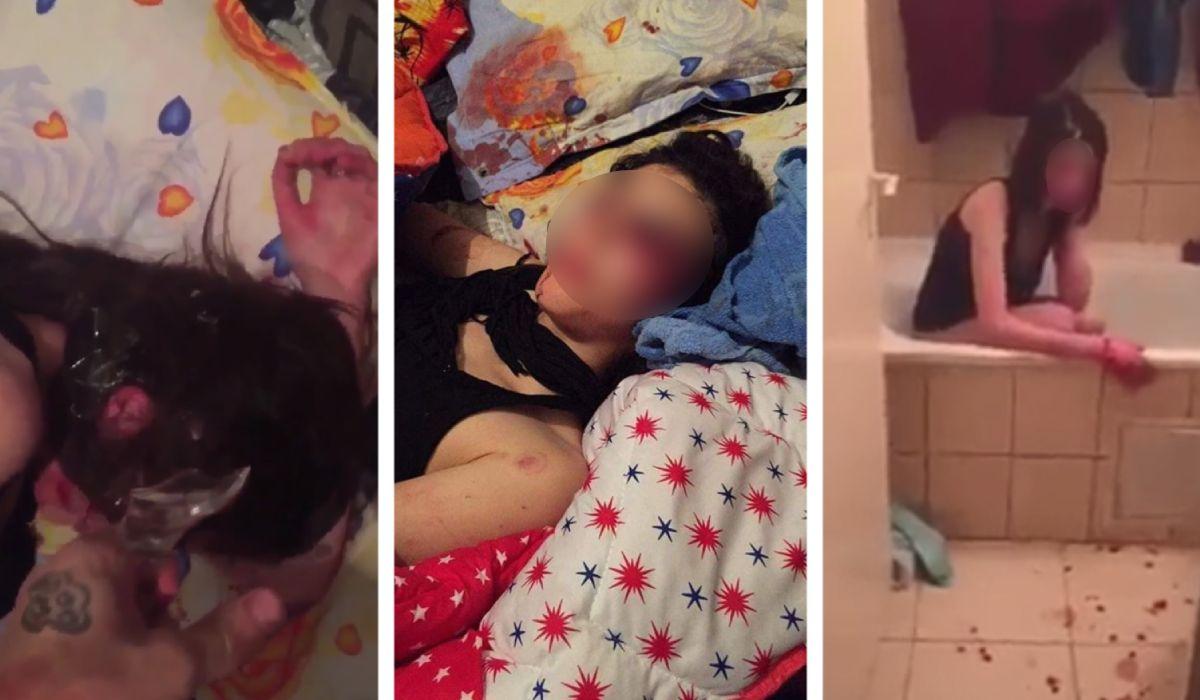 Fata din Ploieşti, bătută de iubit, împlineşte astăzi 18 ani