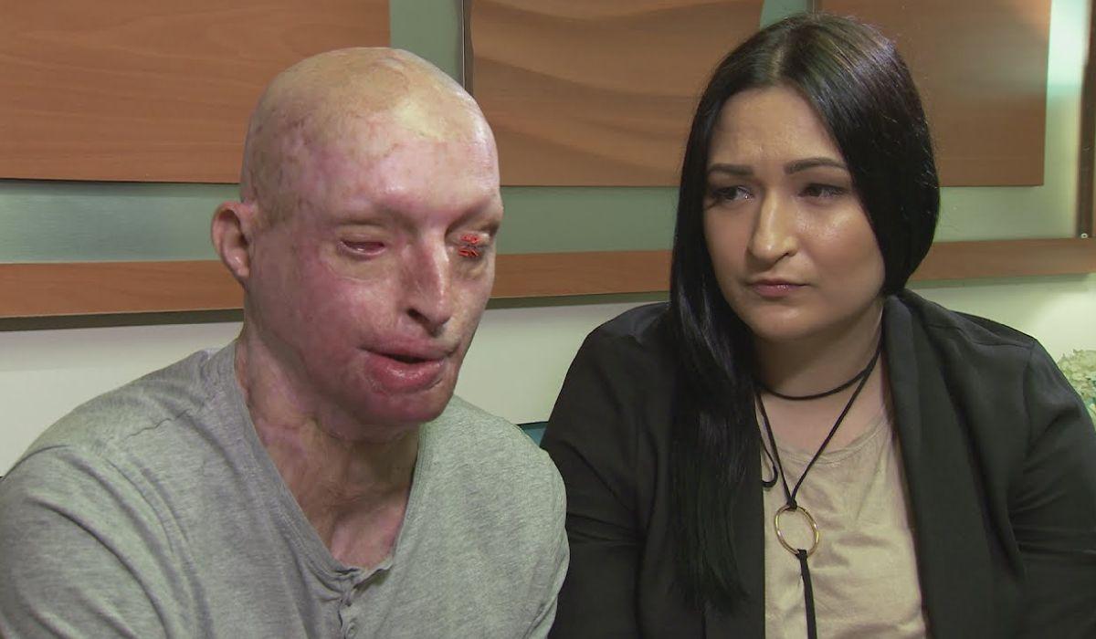 Românul desfigurat cu acid în Anglia are o nouă iubită