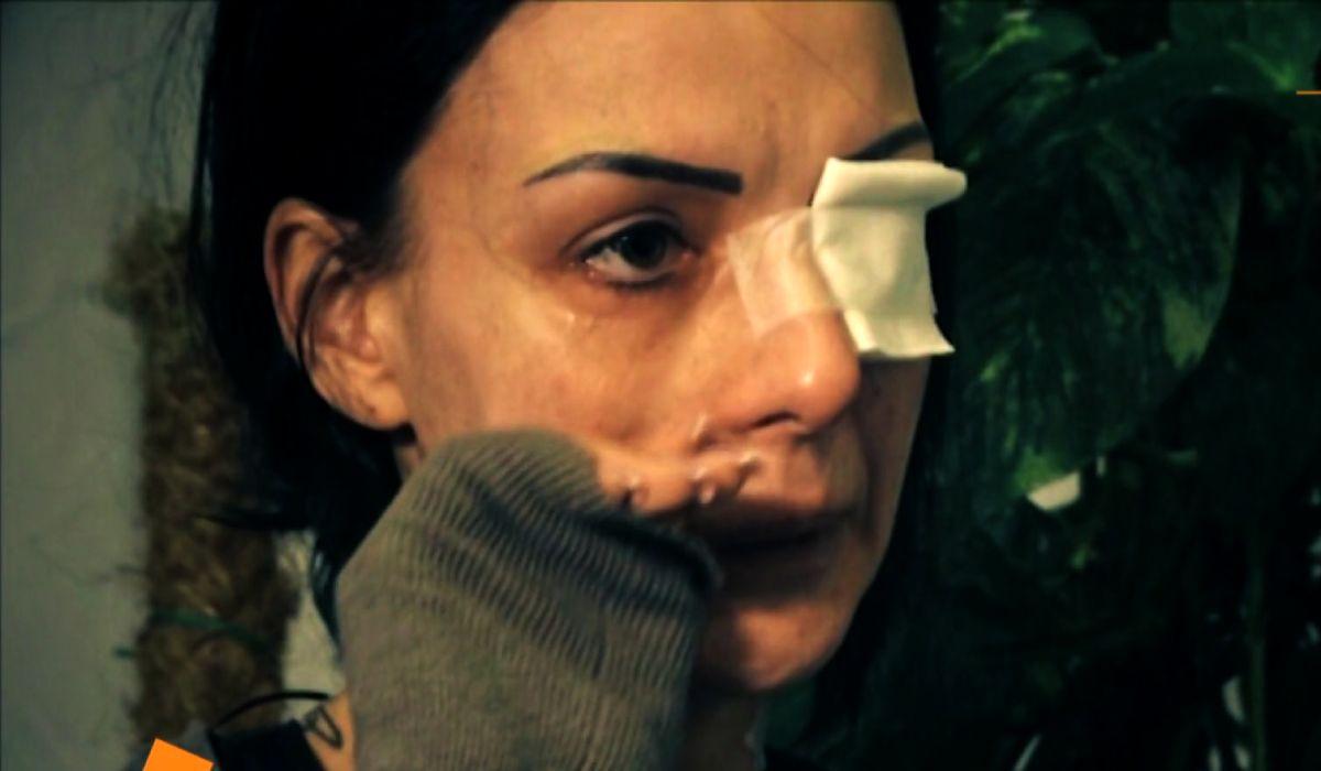 Alina Emilia Paval este romanca atacată în Italia cu acid