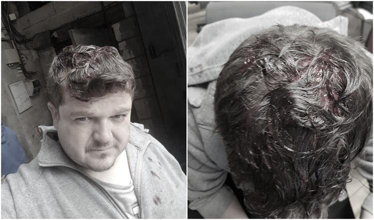 Român snopit în bătaie de alţi români, în Franţa! L-au bătut cu lopeţi şi bucăţi de fier până l-au lăsat lat. Totul a fost filmat de camerele de supraveghere