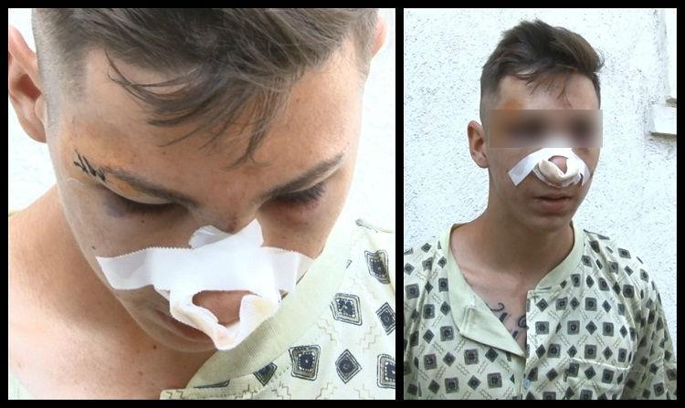 Băiat de 17 ani, bătut crunt şi aruncat într-un şanţ. Patru indivizi l-au călcat pe cap şi lovit cu picioarele și un pumnal până l-au desfigurat