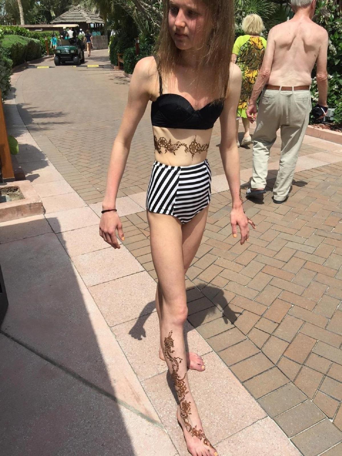 Tânăra anorexică s-a calificat pentru Campionatul Mondial de Culturism