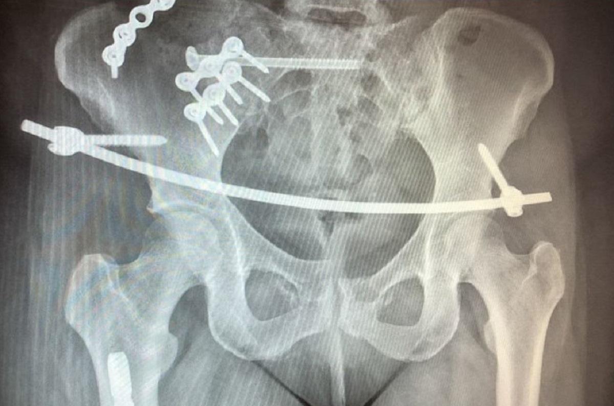 O femeie a supravieţuit în mod miraculos unui accident de maşină de groază