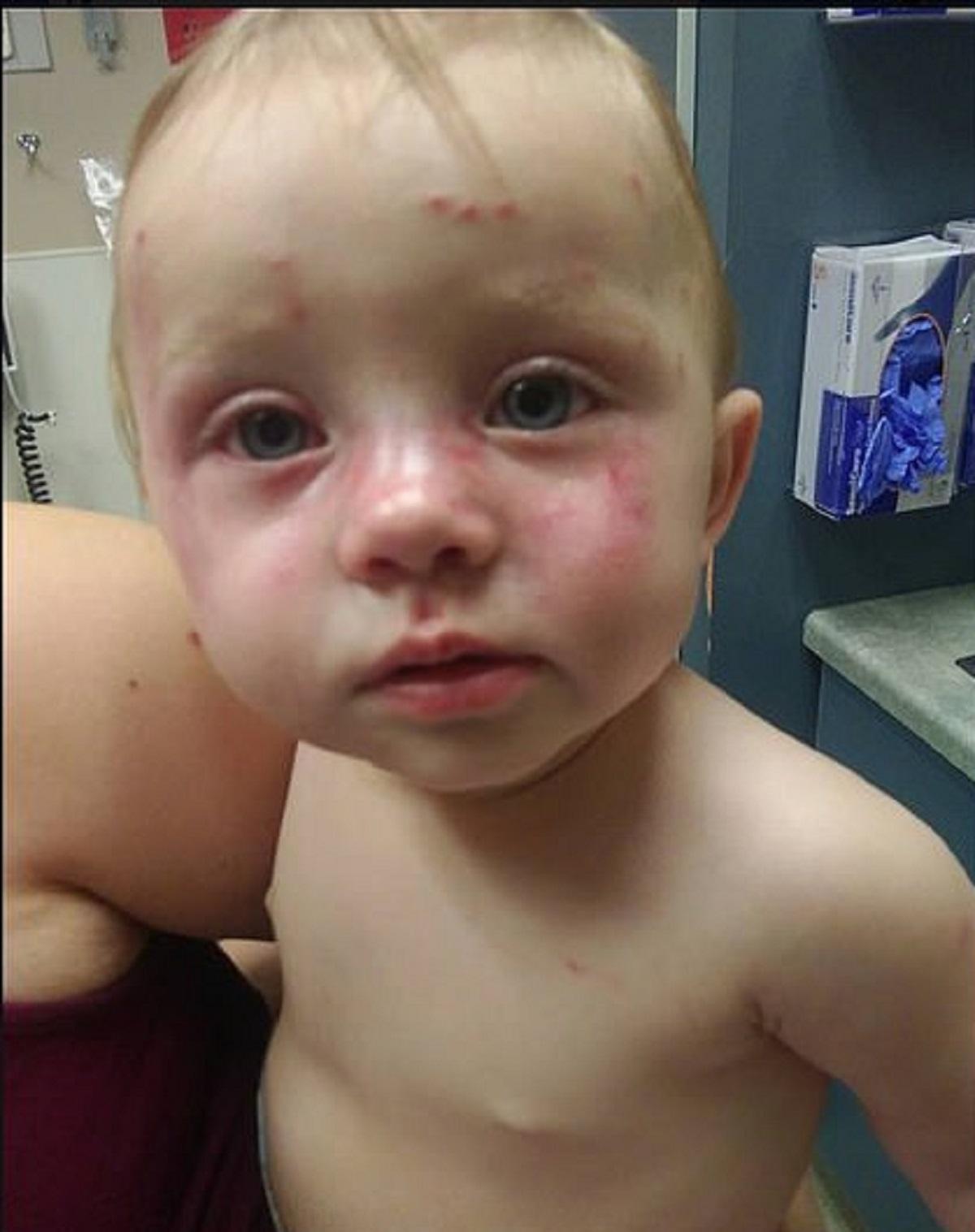 Riley, fetiţa de 11 luni a fost lovită de Marissa, dădacă