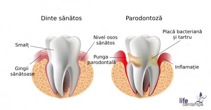 Probleme dentare