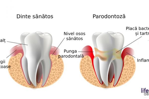 Probleme dentare