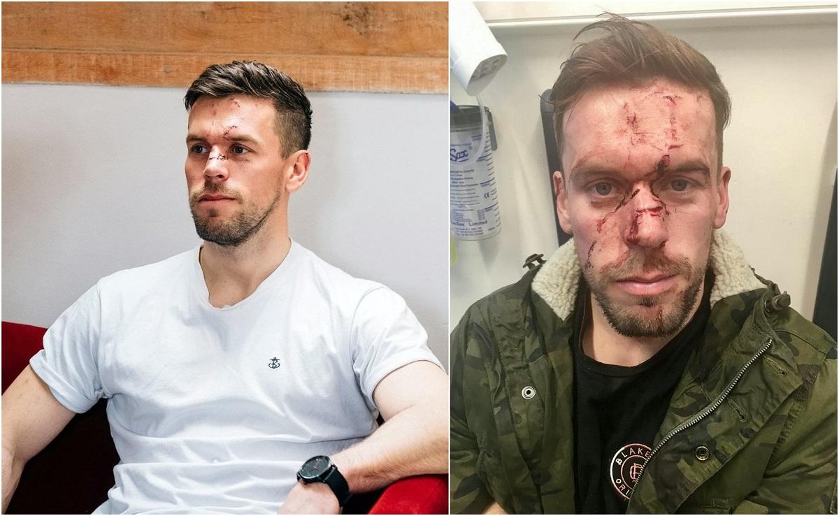 Mire bătut înainte de nuntă