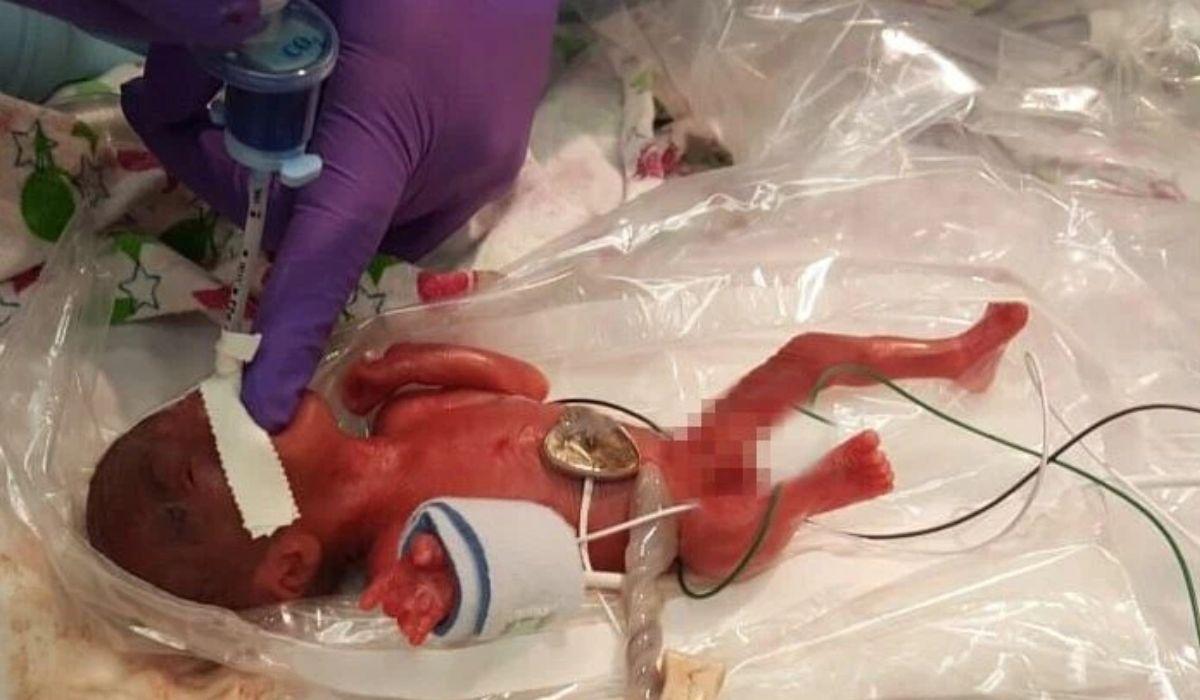 Fetiţa a primit tilul de cel mai mic bebeluş din lume după ce a cântărit 250 de grame la naştere