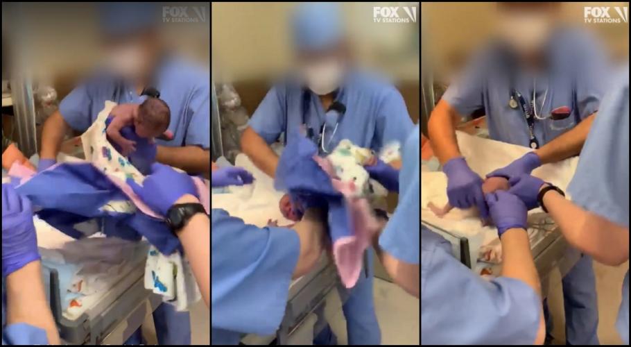 Copil scăpat de medic Copil scăpat din mâini la naștere