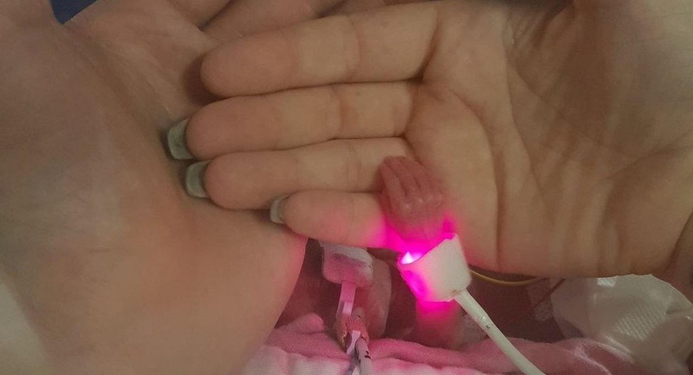 Isabella Evans la nașterea prematură, de 24 de săptămâni