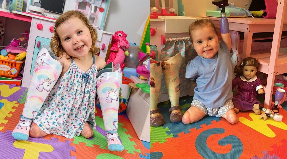 Rămasă fără membre din cauza meningitei, o fetiţă de 5 ani dovedeşte că nimic nu e imposibil