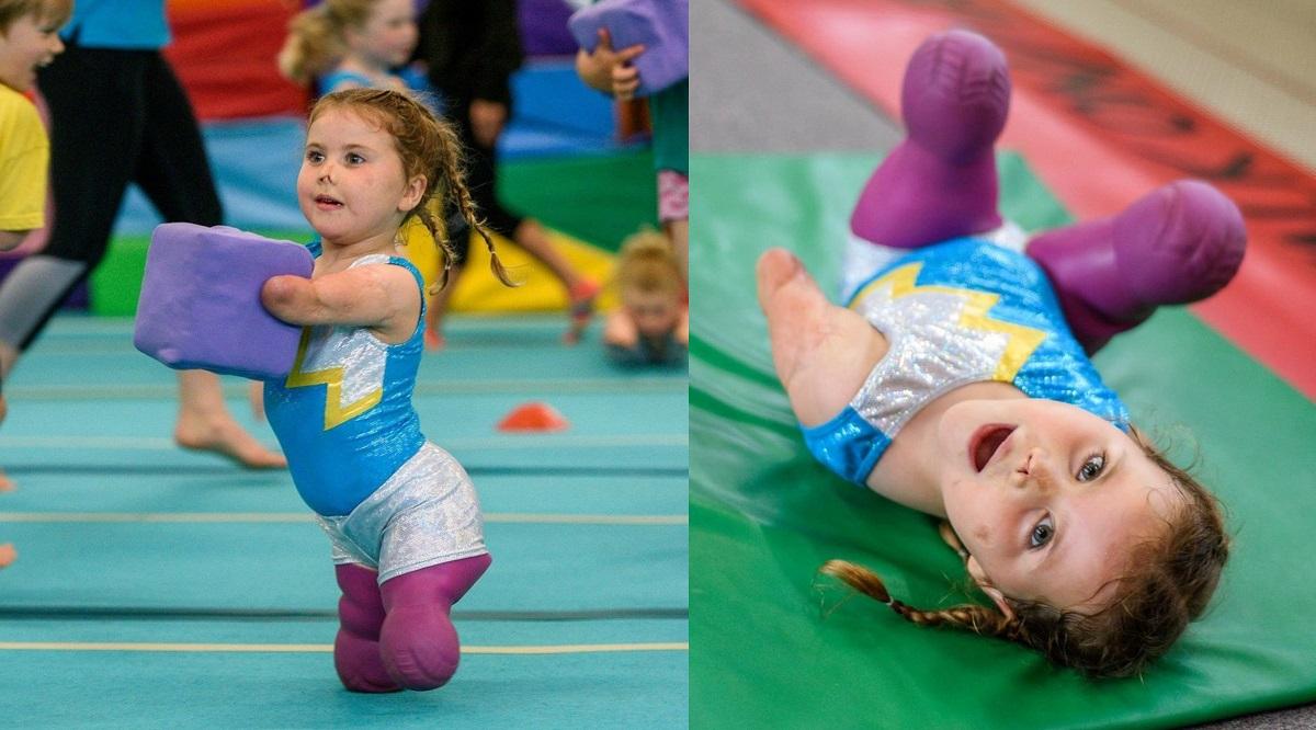 A rămas fără membre din cauza meningitei, dar nu şi-a pierdut visul şi dorinţa de a trăi