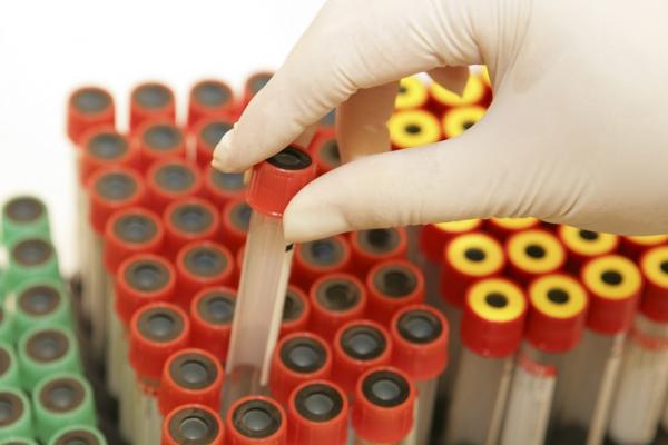 Pacienţii s-au infectat din cauza mâncării primite în spital