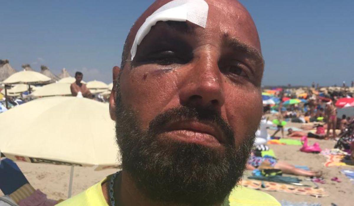 Salvamar rupt în bătaie de un turist arab, în Costineşti