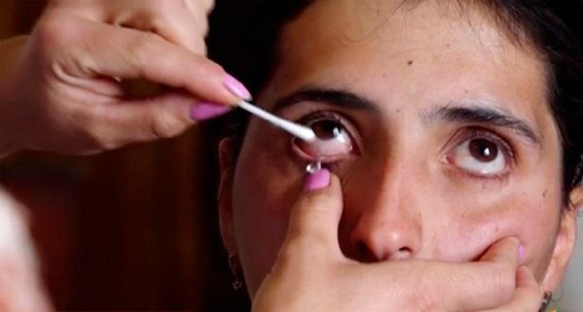 O femeie de 22 de ani plânge cu lacrimi de cristal