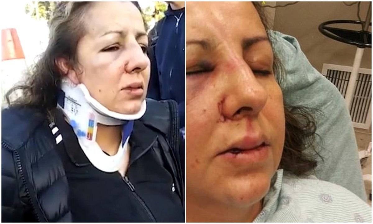 Femeia a fost internată în spital cu răni grave