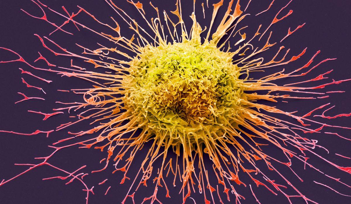 descoperire cancer Descoperire uriaşă a cercetărilor în lupta împotriva cancerului