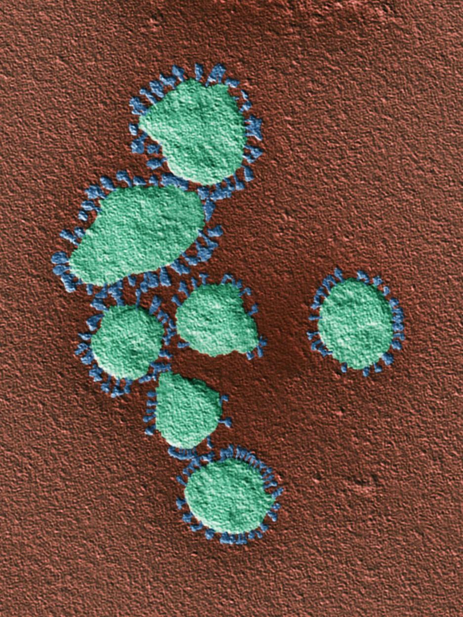 Cum arată o tulpină de coronavirus la microscop