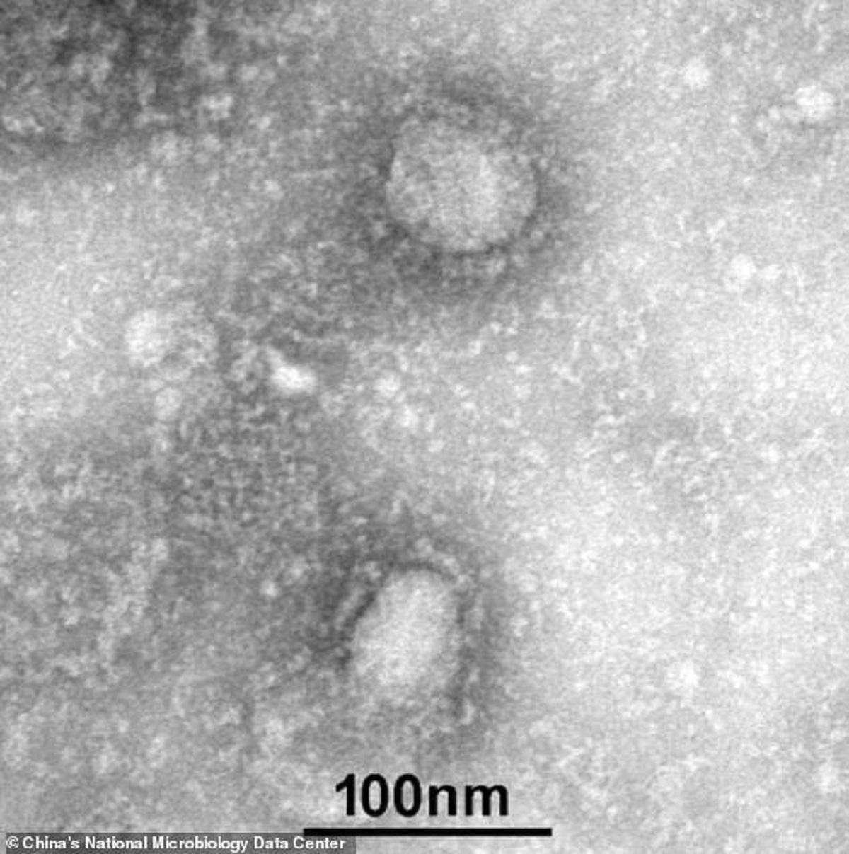 Imagini cu virusul care a ucis, până în prezent, 107 oameni şi a infectat peste 4.400