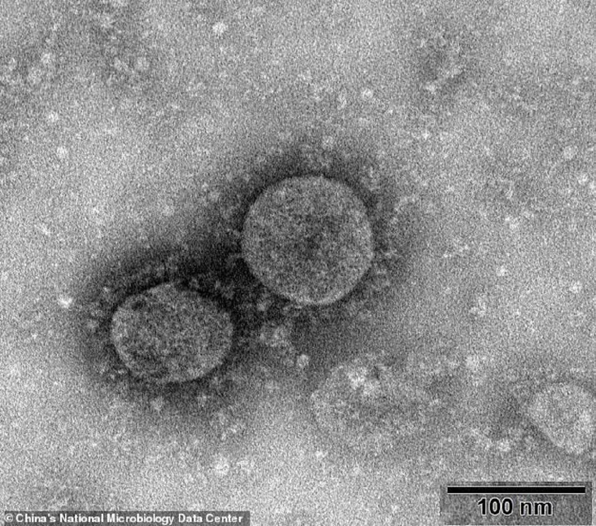 Imagini cu virusul care a ucis, până în prezent, 107 oameni şi a infectat peste 4.400