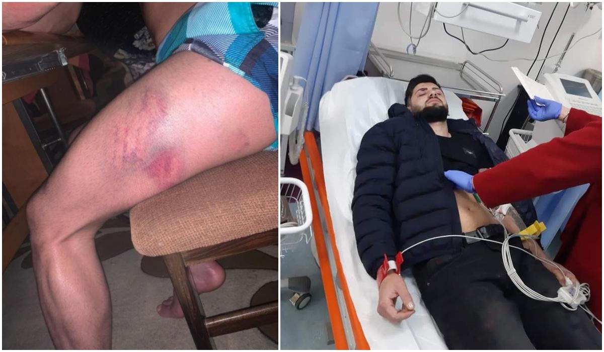 Tinerii bătuţi şi sechestraţi la Lipova