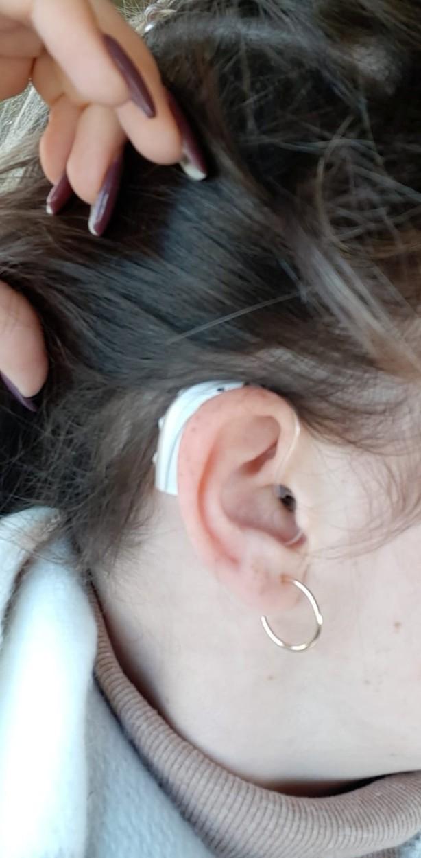 Lauryn arată aparatul auditiv de la urechea stângă