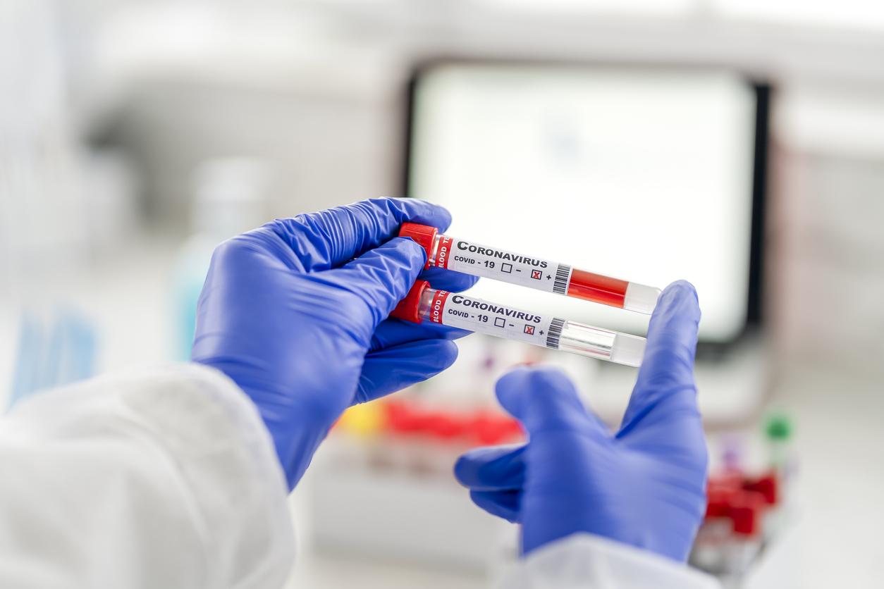 Teste de sânge pentru Covid-19, pe fundalul unui laborator