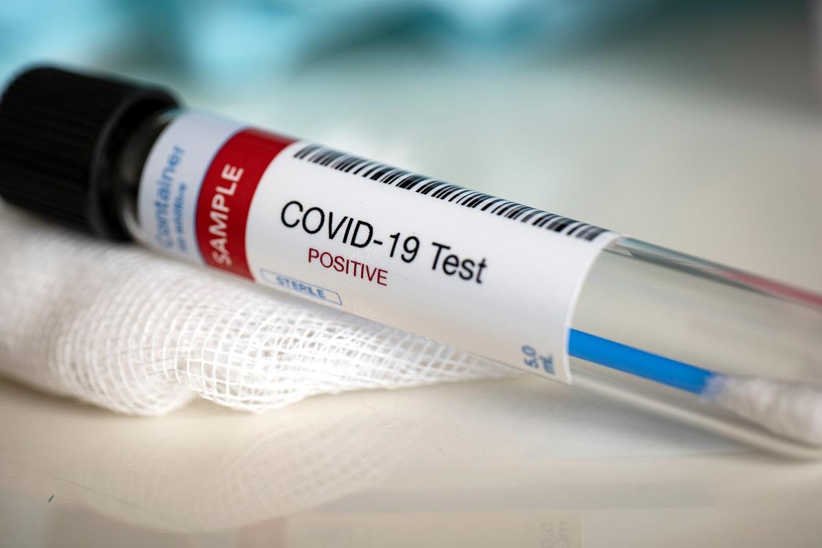 Bilanț coronavirus în România, 27 decembrie 2020 Bilanț coronavirus în România, 27 decembrie 2020