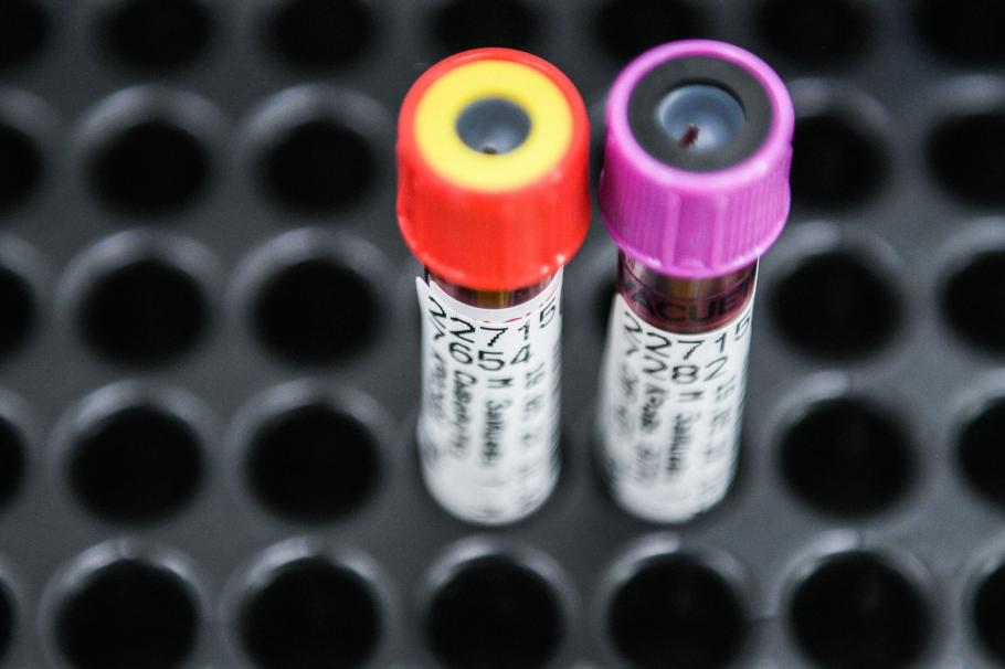 Un deputat de Gorj a anulat carantina în instanță, deși fiul lui este infectat cu noul coronavirus Un deputat de Gorj a anulat carantina în instanță, deși fiul lui este infectat cu noul coronavirus