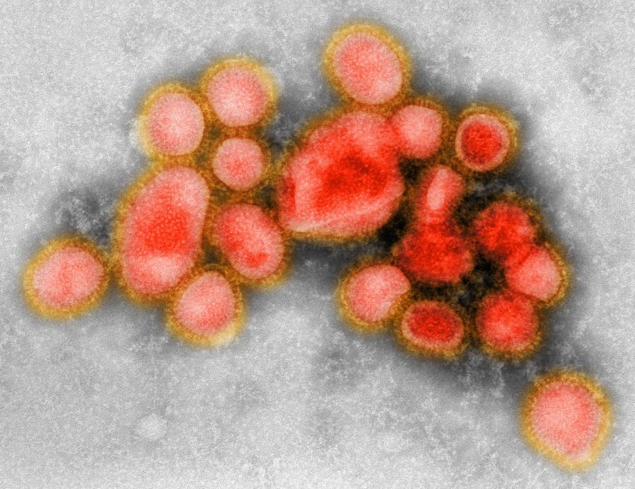 Boală infecțioasă cauzată de un virus abia descoperit în Japonia. Agentul patogen, denumit Yezo, se transmite prin mușcăturile de căpușă și are ”legături” cu un virus din România Virus la microscop