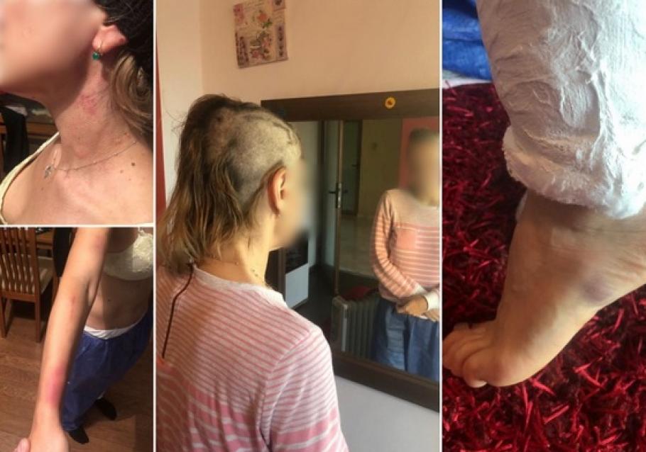 Chinurile groaznice prin care a trecut o femeie din Bihor după ce a fost torturată de copiii patronului firmei la care lucra: "Au schinguit-o, i-au rupt coaste, i-au spart capul, au tuns-o. Nişte monştri!" Chinurile groaznice prin care a trecut o femeie din Bihor după ce a fost torturată de copiii patronului firmei la care lucra: "Au schinguit-o, i-au rupt coaste, i-au spart capul, au tuns-o. Nişte monştri!"