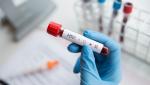 Caz rar: a fost descoperit al doilea pacient care s-a vindecat de HIV fără tratament