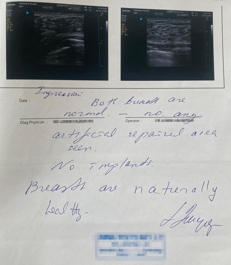 O tânără de 25 de ani din Slovacia se plânge că oamenii nu cred că e reală O tânără de 25 de ani din Slovacia se plânge că oamenii nu cred că e reală