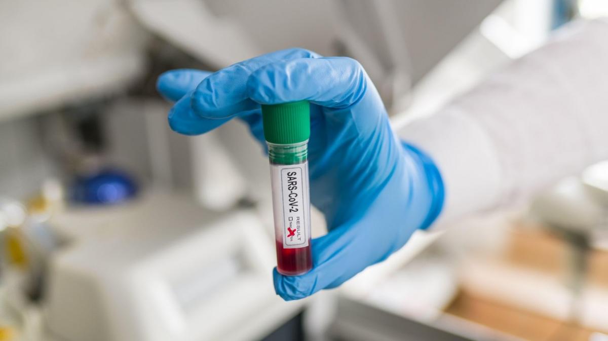 Bilanț coronavirus în România, 18 decembrie 2020 Test pentru depistarea coronavirus