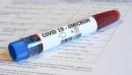 Australia are primul caz de infectare cu Omicron, la un elev care nu a călătorit în afara ţării. Norvegia ar putea deveni focarul Europei în acelaşi mod