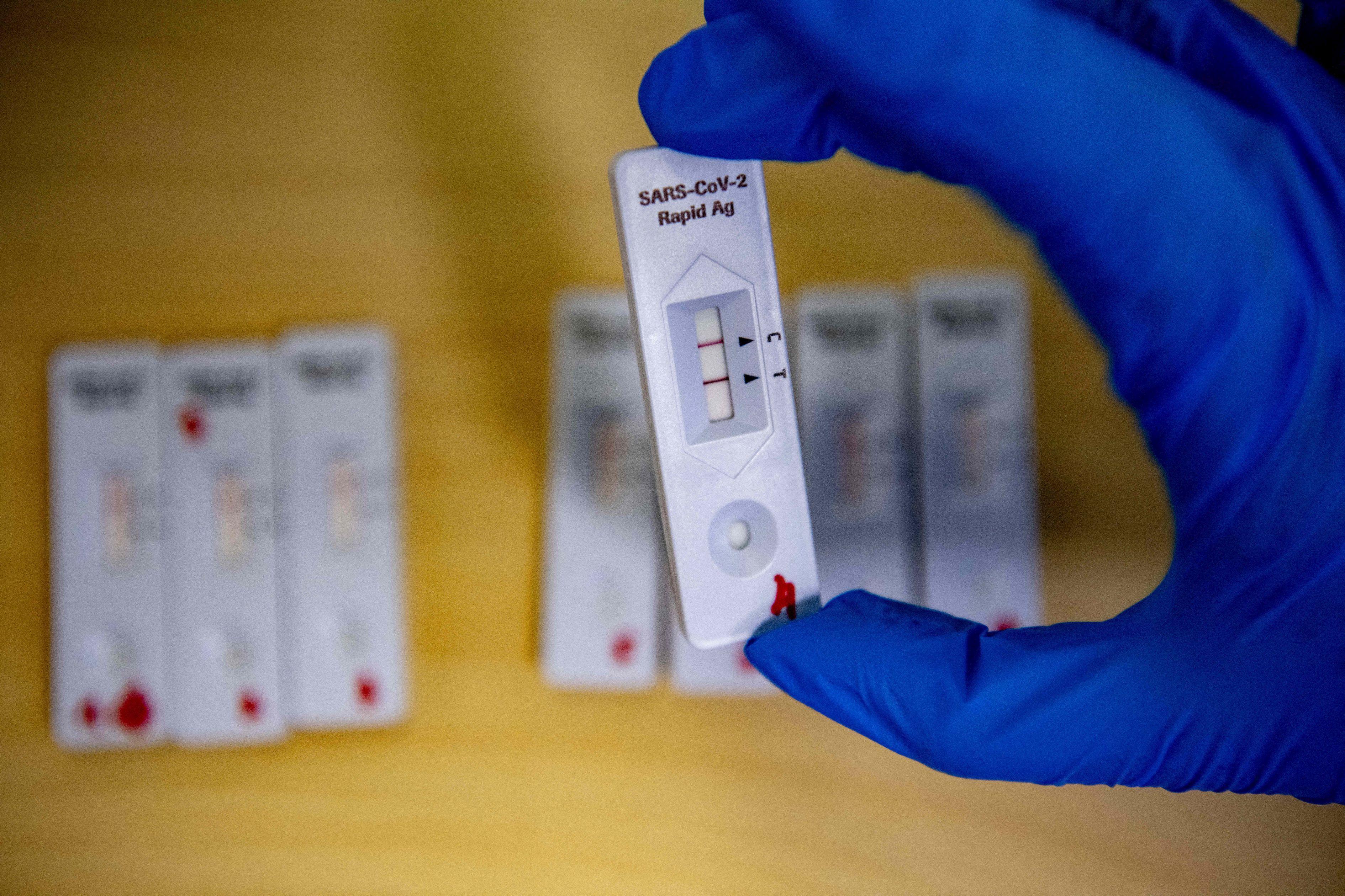 Un cercetător compară rezultatele unor teste rapide cu cele PCR