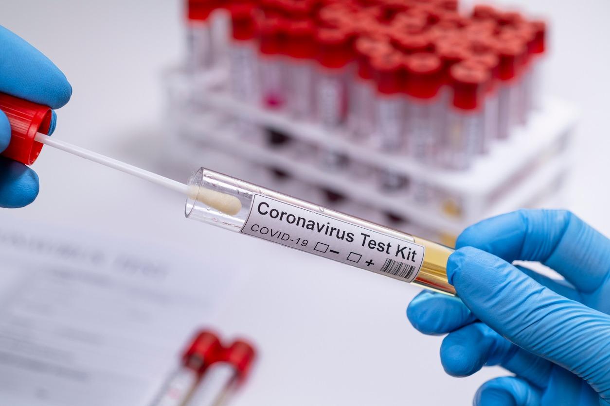 Test pentru depistarea coronavirus