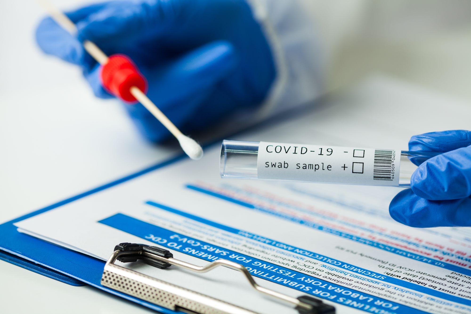 Test covid în contextul bilanțului coronavirus în România, 8 februarie.