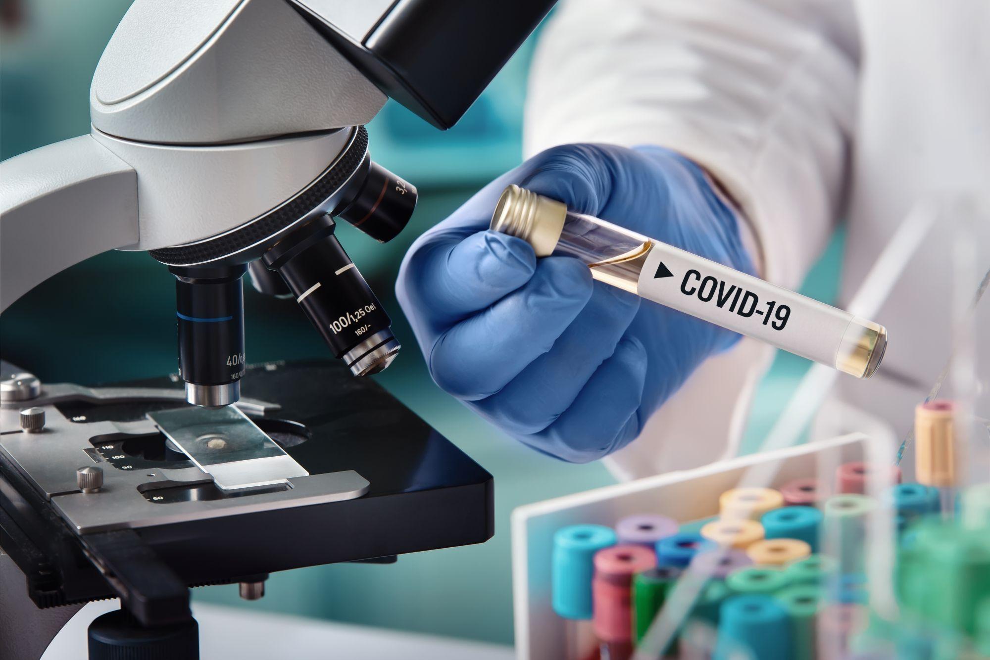 Un microbiolog ține în mână o probă biologică contaminată cu Covid-19