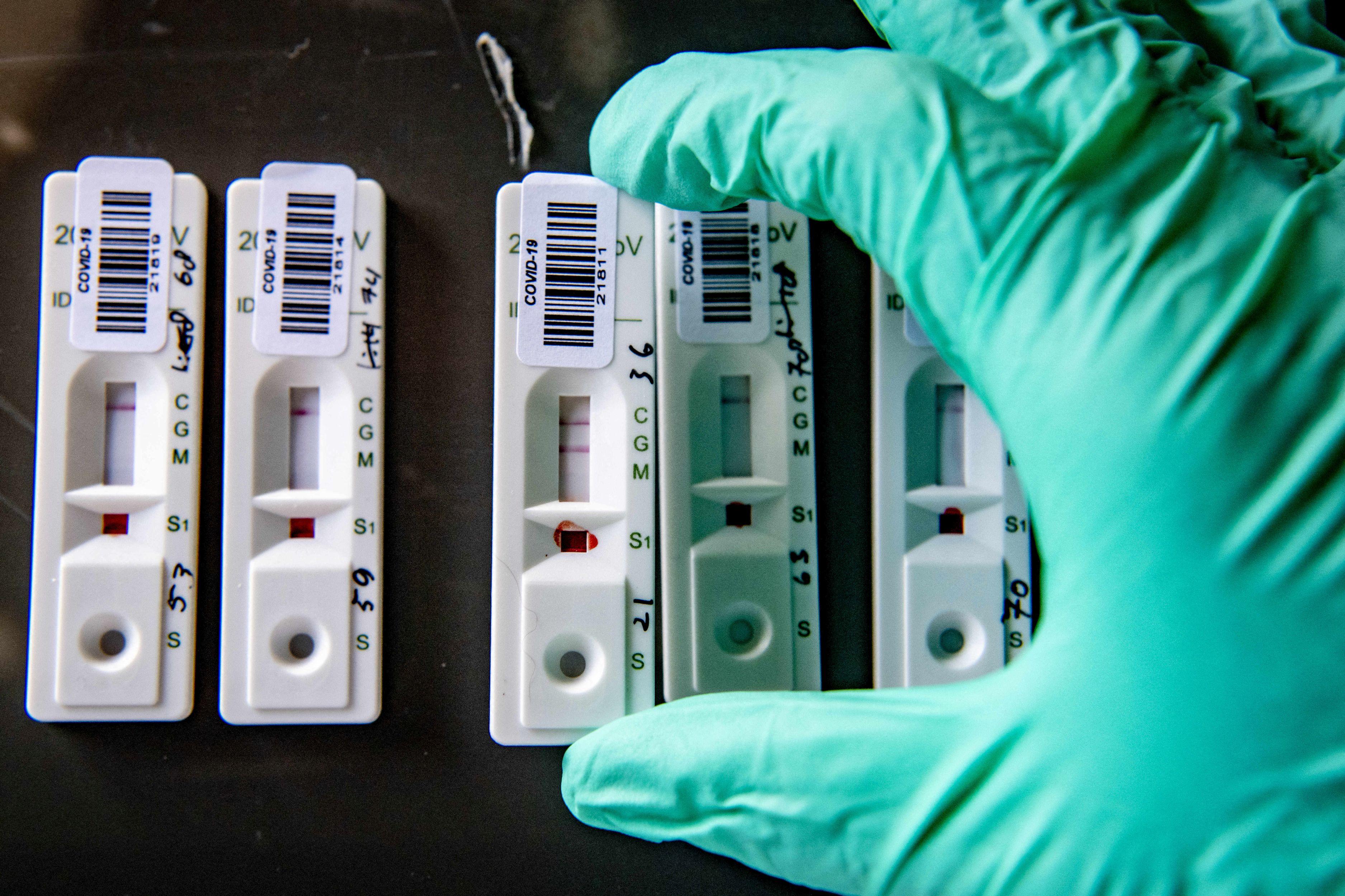 Un asistent așează mai multe teste rapide Covid-19 pe o masă