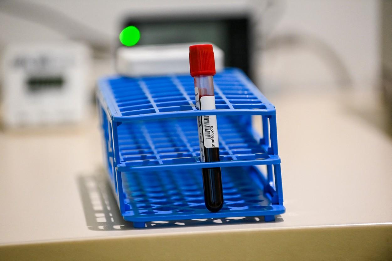 Tot mai mulți români vor testarea anticorpilor după vaccinare. Cum funcționează și cât costă testele neutralizante Tot mai mulți români vor testarea anticorpilor după vaccinare. Cum funcționează și cât costă testele neutralizante