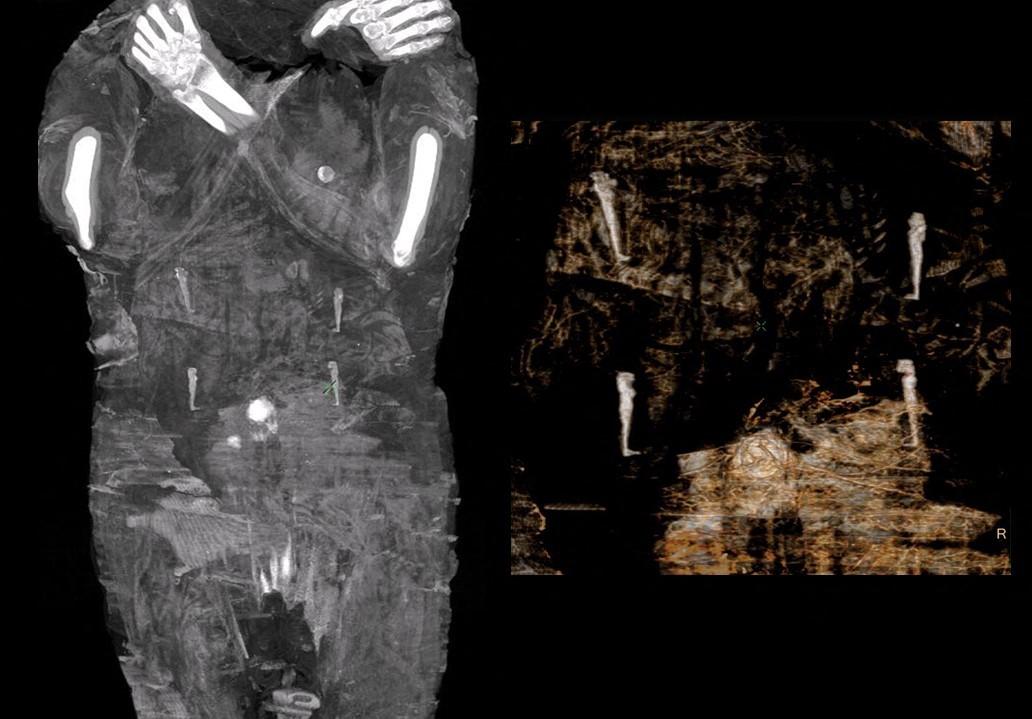 Prima mumie însărcinată, descoperită de oamenii de știință polone
