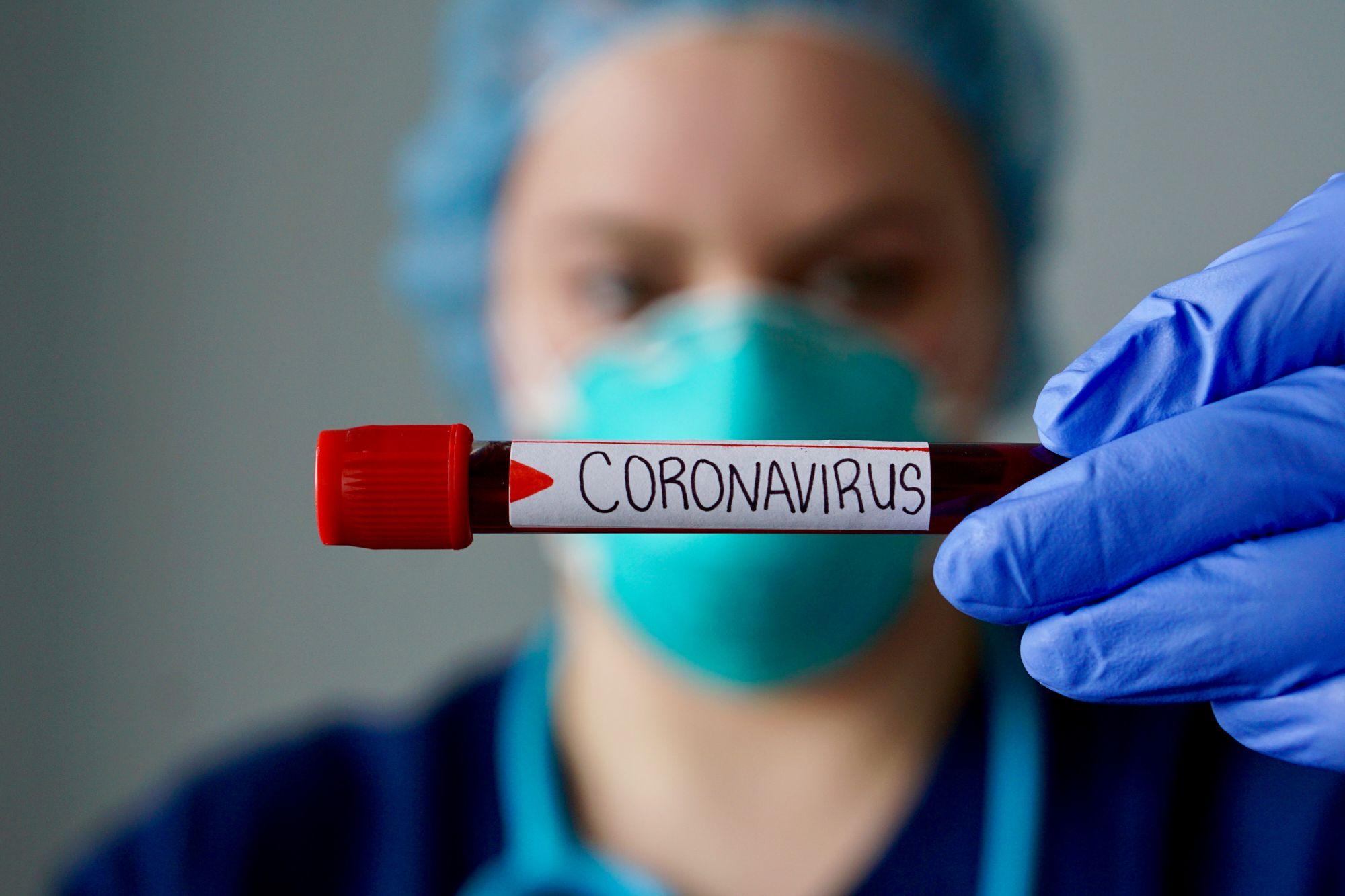 O asistentă ține în mână o eprubetă cu o probă de sânge pe care scrie Coronavirus