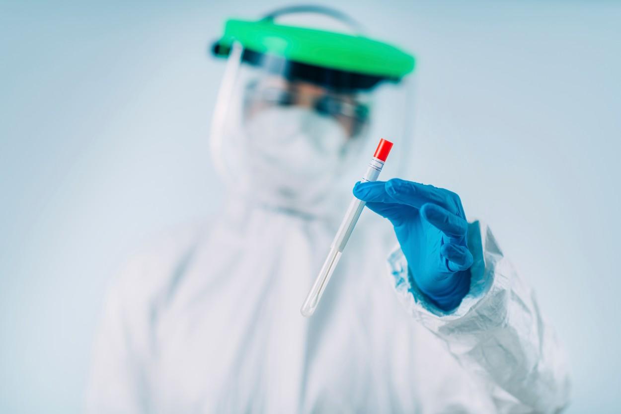 Coronavirusul suferă tot mai multe mutaţii. Ce este tulpina Gamma? A fost descoperită în SUA, face ravagii în Brazilia Coronavirusul suferă tot mai multe mutaţii. Ce este tulpina Gamma? A fost descoperită în SUA, face ravagii în Brazilia