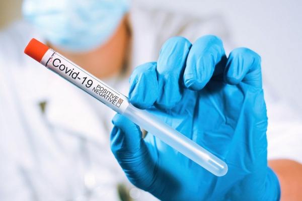 Eprubeta pe care scrie test pozitiv la Covid-19